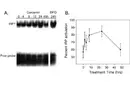Ferritin 7 Ferritin Düşüklüğü Ferritin 7 Ferritin Düşüklüğü