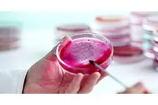 Ferritin Nasıl Yükseltilir? Ferritin Nasıl Yükseltilir?