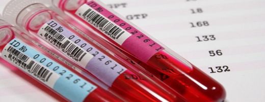 Ferritin Düşüklüğü Belirtileri ve Tedavisi