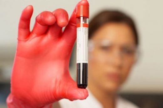 Normal Durumlarda Ferritin Hormonu