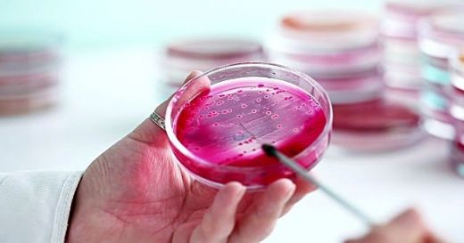 Ferritin Nasıl Yükseltilir?