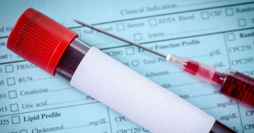 Ferritin Yüksekliği Nasıl Düşürülebilir?