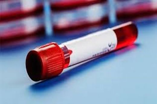 Hormon Ferritin Değerleri