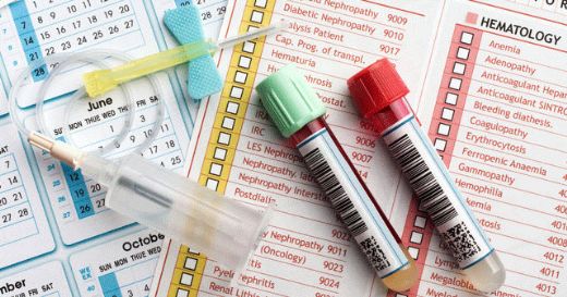 Kan Tahlili Ferritin Değeri